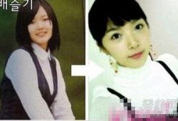 韩国整容失败爆料视频,美丽背后隐藏的惊悚真相