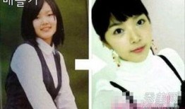 韩国整容失败爆料视频,美丽背后隐藏的惊悚真相